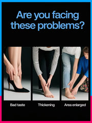 nail laser for Onychomycosis