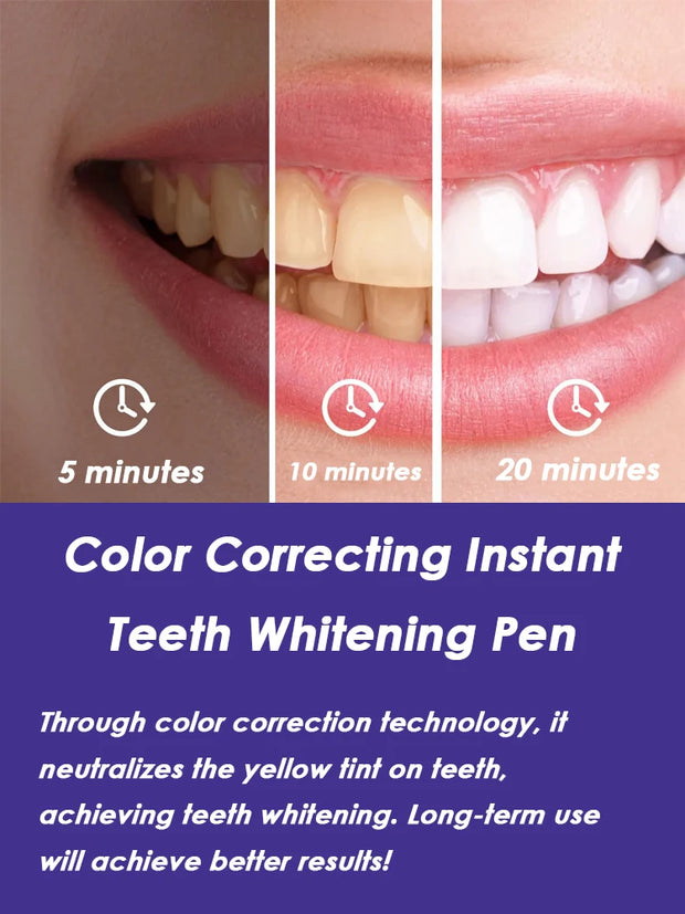 Purple Instant Teeth Whitening Pen
